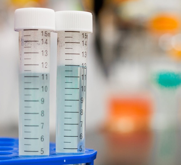 Valneva ferme son site de Nantes et accélère la rationalisation de son organisation